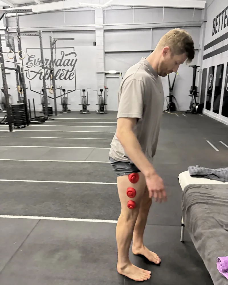Treatment session
